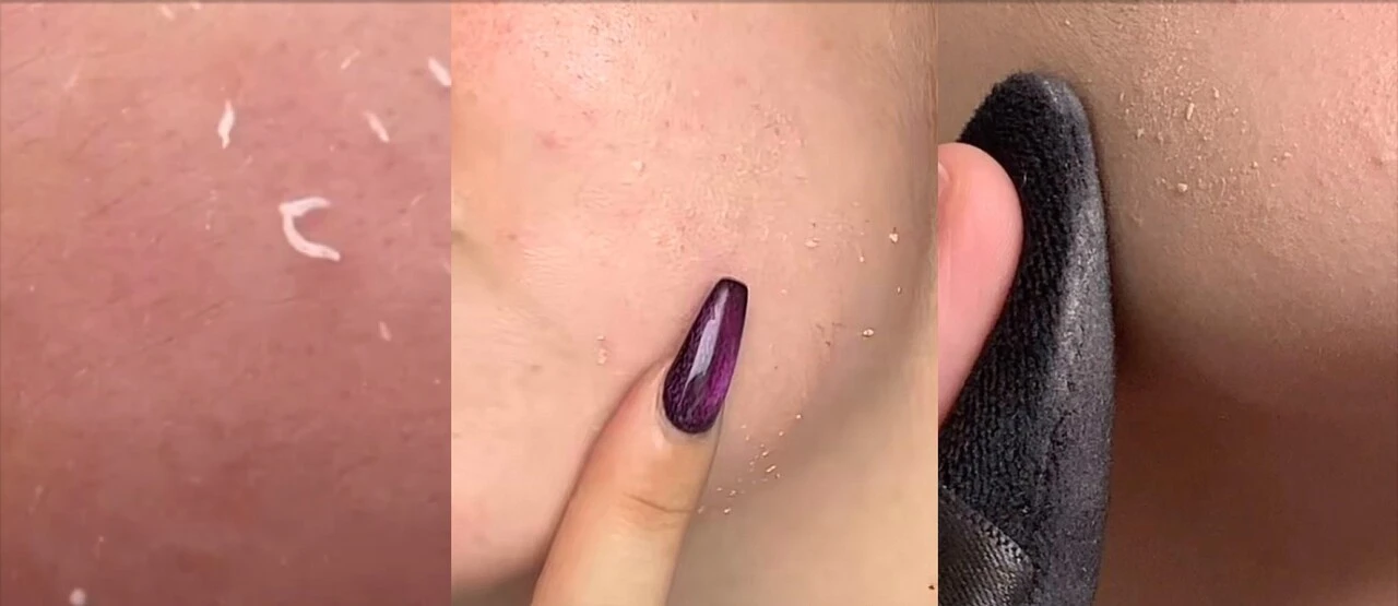 6 dôvodov, prečo sa ti žmolkuje make-up alebo skincare – a ako tomu predísť