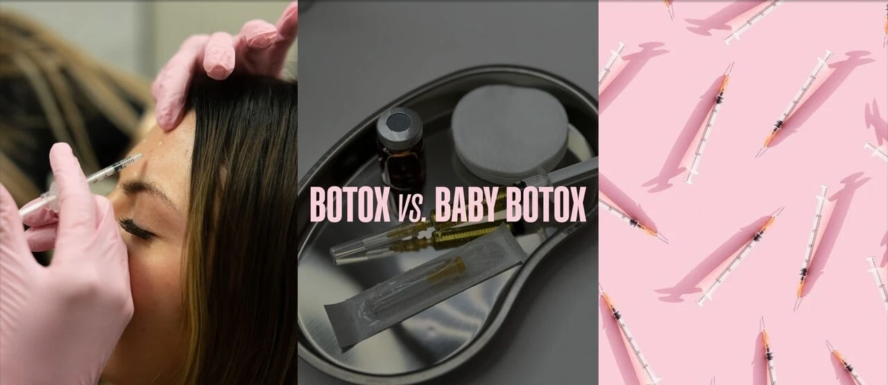 Botox vs. baby botox: Kedy je ten správny čas začať? Odpoveď ťa možno prekvapí