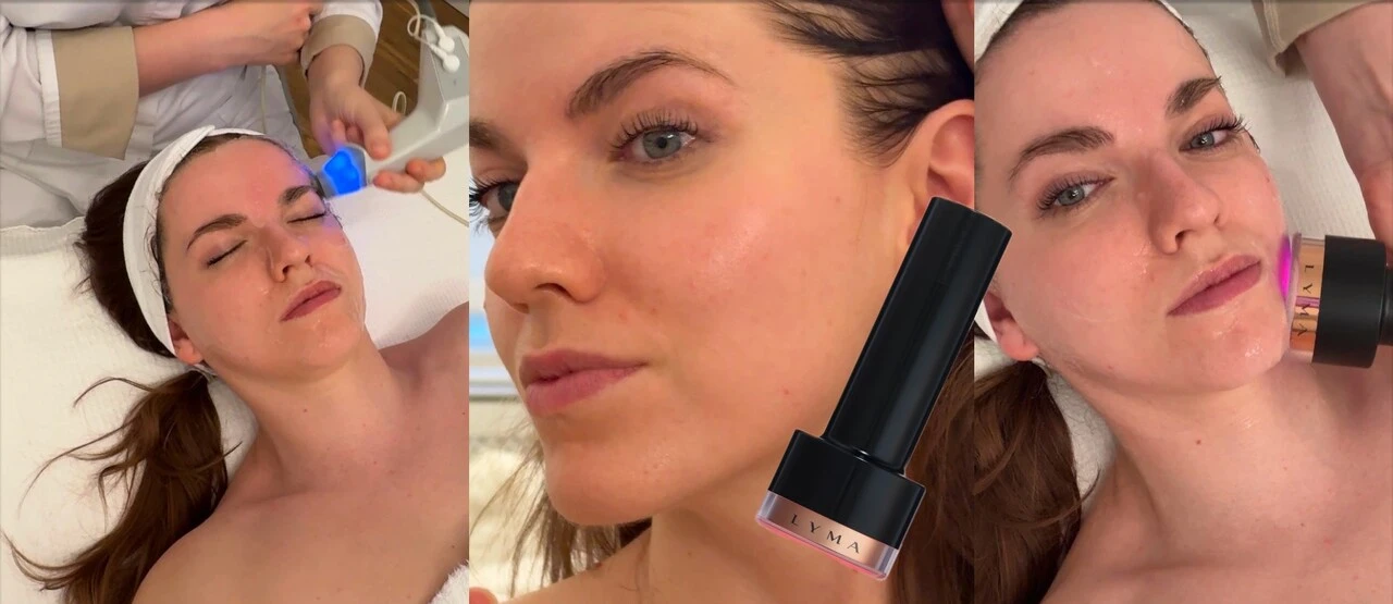 Celebrity naň nedajú dopustiť: Lyma Laser ako beauty tajomstvo hviezd 