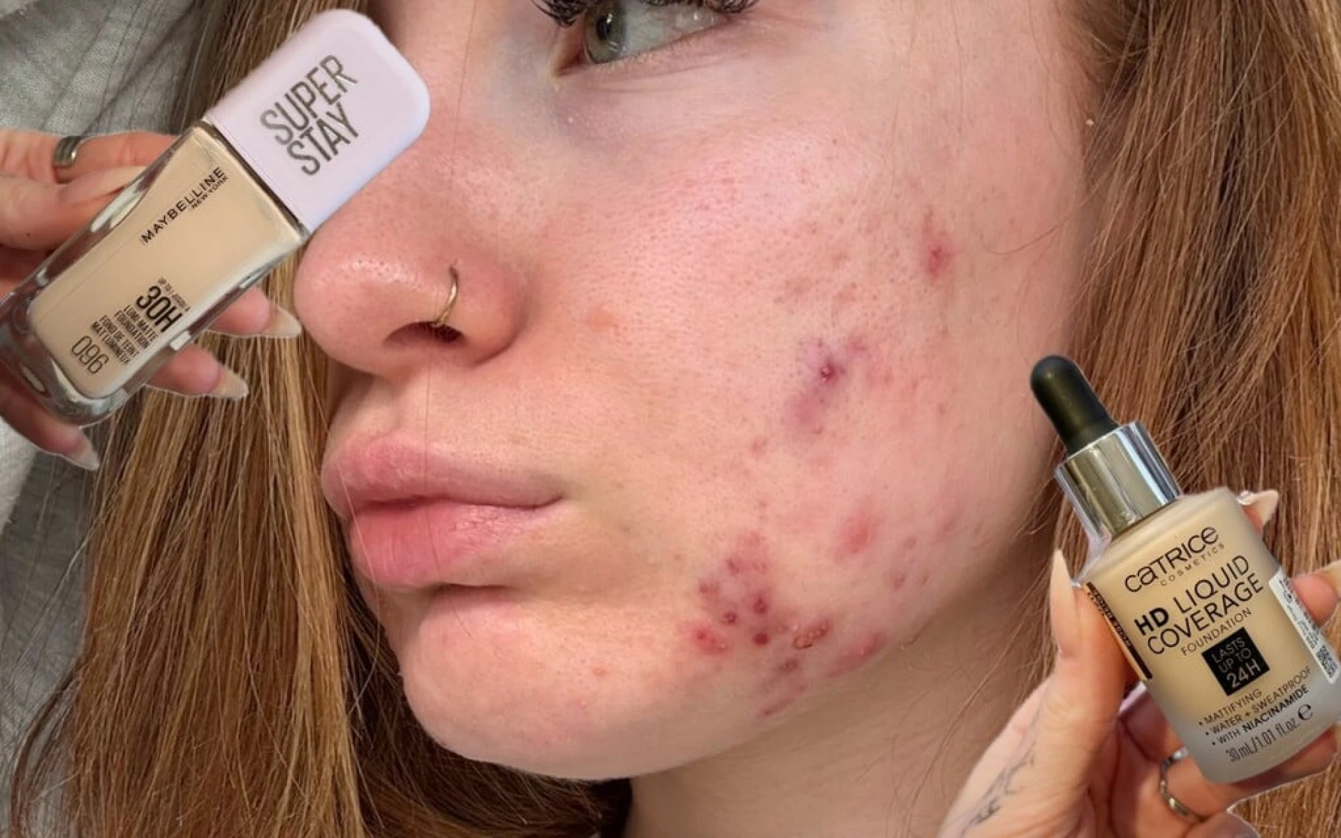 Najlepší make-up pre aknóznu pleť: 4 overené tipy z drogérie po 10 rokoch boja s akné