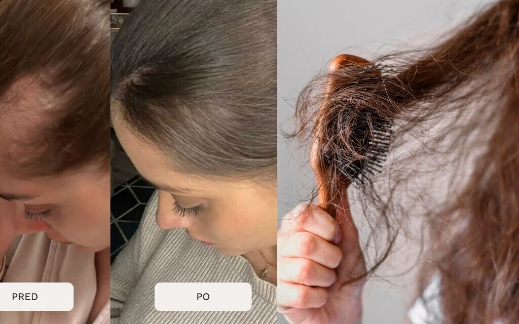 Toto sú najčastejšie mýty o raste vlasov. Zabudni na časté strihanie či drahé šampóny a zisti, čo naozaj funguje