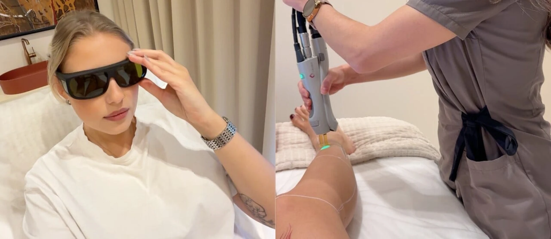 Všetko, čo potrebuješ vedieť o laserovej epilácii: Koľko stojí a koľko sedení potrebuješ?