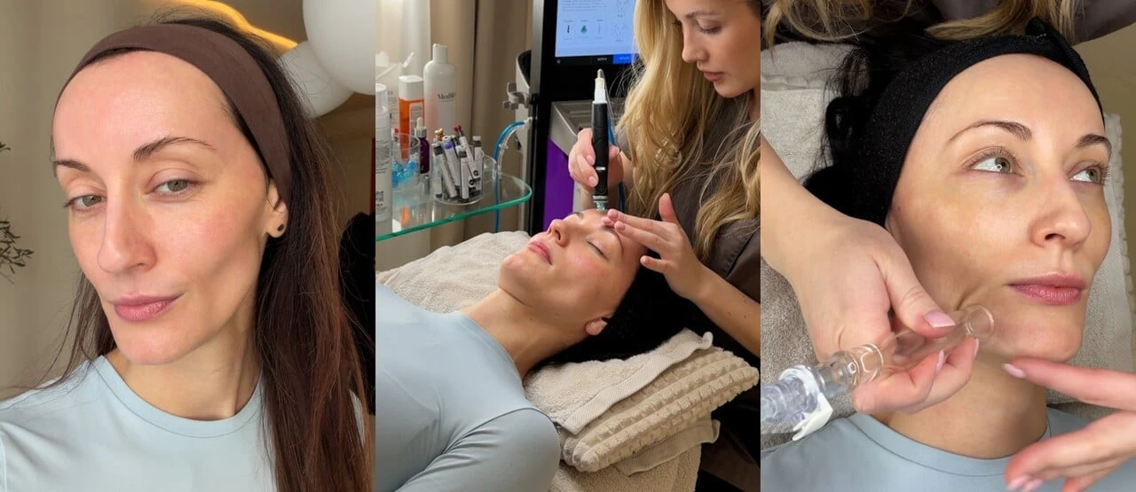 Vyskúšala som HydraFacial: Toto ošetrenie ti pleť doslova „vysaje“ do dokonalosti