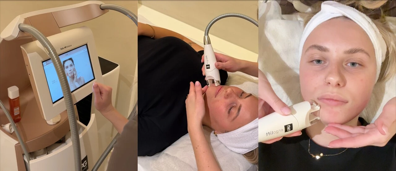 Vyskúšala som LPG Face na dvojitú bradu. Funguje to?